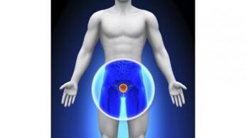 prostatitis pada pria