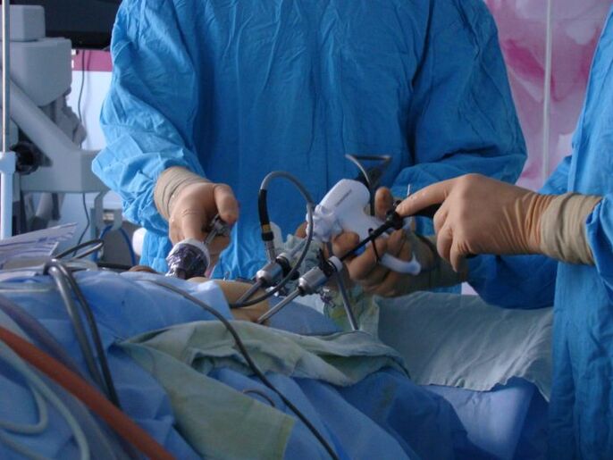 perawatan bedah prostatitis