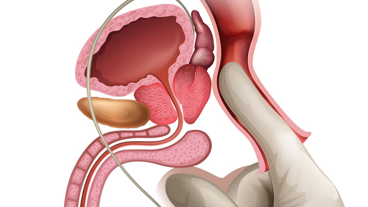 Pijat prostat adalah cara yang efektif untuk mengobati prostatitis kongestif