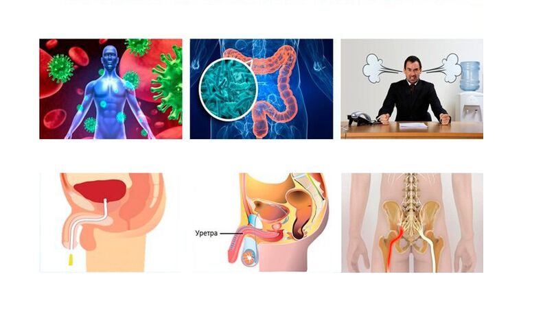 penyebab prostatitis