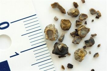 Batu